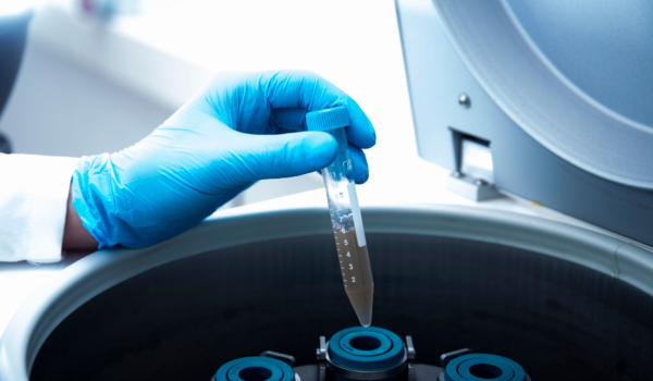 PRP in Fertility Care – What You Need to Know