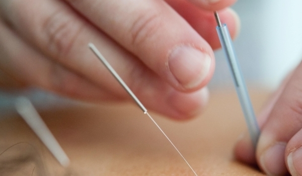 Can complementary therapies like acupuncture help conception?